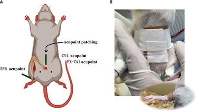 To explore the mechanism of acupoint application in the treatment of primary dysmenorrhea by 16S rDNA sequencing and metabolomics